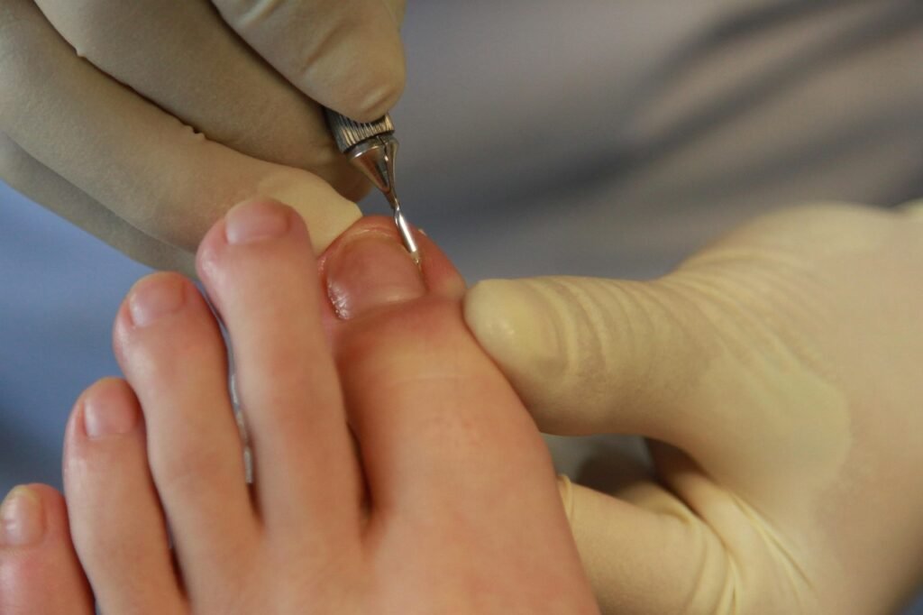 toenails, foot care, foot, nail care, toes, hygiene, hand tool, podiatrist, closeup, toenails, toenails, toenails, toenails, foot care, foot care, foot care, foot care, foot care, nail care, podiatrist, podiatrist, podiatrist, podiatrist